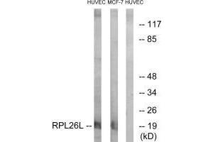 Western blot analysis of extracts from HUVEC cells and MCF-7 cells, using RPL26L antibody. (RPL26L1 anticorps  (C-Term))