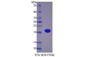 SDS-PAGE analysis of Rat PLTP Protein. (PLTP Protéine)