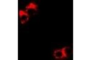 Immunofluorescent analysis of DDX1 staining in Hela cells. (DDX1 anticorps)