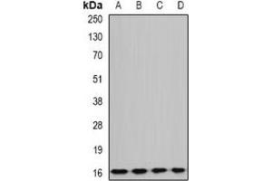 Western blot analysis of GABARAPL1 expression in BT474 (A), mouse liver (B), rat brain (C), rat kidney (D) whole cell lysates. (GABARAPL1 anticorps)