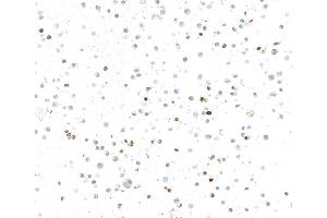 anti-Insulinoma-Associated 1 (INSM1) (AA 75-125) antibody