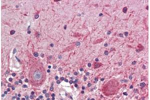 Human Brain, Cerebellum (formalin-fixed, paraffin-embedded) stained with ATF4 antibody ABIN462203 followed by biotinylated goat anti-rabbit IgG secondary antibody ABIN481713, alkaline phosphatase-streptavidin and chromogen.