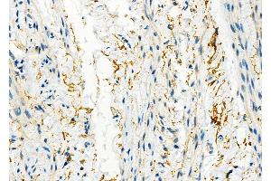 anti-Tumor Necrosis Factor (Ligand) Superfamily, Member 12 (TNFSF12) (N-Term) antibody