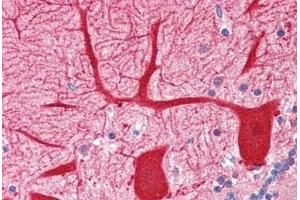 Human Brain, Cerebellum (formalin-fixed, paraffin-embedded) stained with OPTN antibody ABIN364456 at 2.