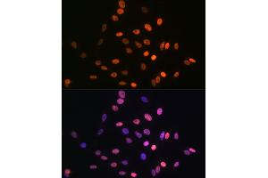 Immunofluorescence analysis of C6 cells using HMG Rabbit mAb (ABIN7267646) at dilution of 1:100 (40x lens).
