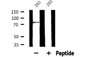 Western blot analysis of extracts from 293, using GUSB Antibody. (Glucuronidase beta anticorps  (Internal Region))