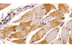 Detection of NRP1 in Human Skeletal muscle Tissue using Monoclonal Antibody to Neuropilin 1 (NRP1) (Neuropilin 1 anticorps  (AA 646-814))