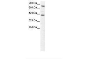 Image no. 1 for anti-Zinc Finger Protein 652 (ZNF652) (AA 97-146) antibody (ABIN6735826) (ZNF652 anticorps  (AA 97-146))