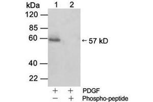 Western blot analysisLane 1: Cell lysate from NIH/3T3 cells stimulated with 50 ng/ml PDGFLane 2: Cell lysate from NIH/3T3 cells stimulated with 50 ng/ml PDGF and blocked with phosphopeptidePrimary Antibody: Rabbit Anti-Akt (Phospho-Ser473) Polyclonal Antibody (ABIN398632) Secondary Antibody: 0. (AKT1 anticorps  (pSer473))