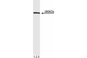 Western blot analysis of beta-Spectrin II on Jurkat lysate. (SPTBN1 anticorps  (AA 2101-2189))