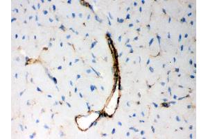 IHC analysis of BAK using anti-BAK antibody .