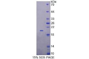 SDS-PAGE analysis of Human GALR4 Protein. (GPR151 Protéine)