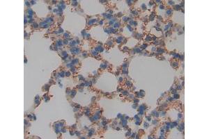 Used in DAB staining on fromalin fixed paraffin- embedded lung tissue