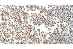 Immunohistochemistry of paraffin-embedded Human tonsil tissue using SPDEF Polyclonal Antibody at dilution 1:60
