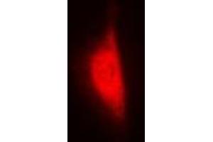 Immunofluorescent analysis of WBSCR22 staining in MCF7 cells.