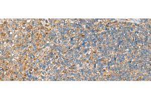 Immunohistochemistry of paraffin-embedded Human tonsil tissue using NQO2 Polyclonal Antibody at dilution of 1:70(x200)
