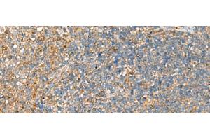 Immunohistochemistry of paraffin-embedded Human tonsil tissue using NQO2 Polyclonal Antibody at dilution of 1:70(x200)
