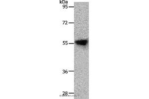 Western blot analysis of Human liver cancer tissue, using SLC1A4 Polyclonal Antibody at dilution of 1:800 (SLC1A4 anticorps)