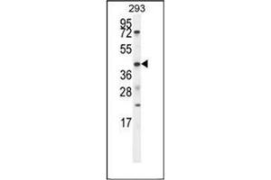 Western blot analysis of ETV5 / ERM Antibody (N-term) in 293 cell line lysates (35ug/lane). (ETV5 anticorps  (N-Term))