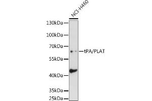 Western blot analysis of extracts of NCI-H460 cells, using tPA/tPA/PLAT antibody (ABIN6128802, ABIN6145743, ABIN6145744 and ABIN6221299) at 1:1000 dilution.