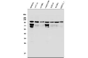 Western blot analysis of HGS using anti-HGS antibody (ABIN7601205).