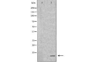 Western blot analysis of GST-SPINK1 recombinant protein using SPINK1 antibody.