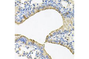 Immunohistochemistry of paraffin-embedded mouse lung using SKAP2 antibody. (SKAP2 anticorps)