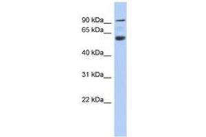 Acap3 anticorps  (AA 107-156)