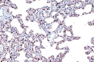 Immunohistochemistry of paraffin-embedded rat lung using PDCD4 Rabbit mAb  at dilution of 1:100 (40x lens).