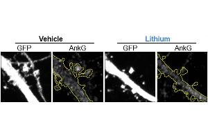 Representative maximal projection of a confocal image of endogenous AnkG (cat. (Ankyrin G anticorps)