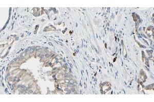 ABIN6278532 at 1/100 staining Human prostate tissue by IHC-P. (STEAP1 anticorps  (N-Term))