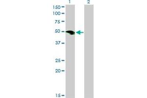 Western Blot analysis of SMOC1 expression in transfected 293T cell line by SMOC1 monoclonal antibody (M03), clone 8F10.