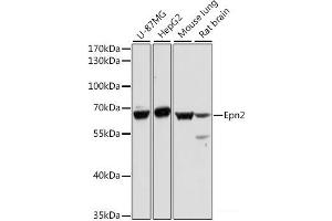 Western blot analysis of extracts of various cell lines using Epn2 Polyclonal Antibody at dilution of 1:1000.