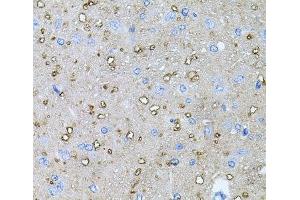 Immunohistochemistry of paraffin-embedded Rat brain using NTF4 Polyclonal Antibody at dilution of 1:100 (40x lens). (Neurotrophin 4 anticorps)