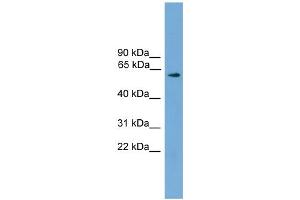WB Suggested Anti-RIC8A Antibody Titration: 0. (RIC8A anticorps  (N-Term))