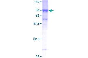 Image no. 1 for Meis Homeobox 3 (MEIS3) (AA 1-421) protein (GST tag) (ABIN1310708)