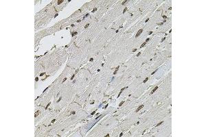 Immunohistochemistry of paraffin-embedded mouse heart using CTNNB1 antibody (ABIN5997534) at dilution of 1/100 (40x lens). (CTNNB1 anticorps)