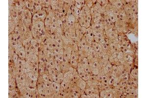 IHC image of ABIN7139851 diluted at 1:400 and staining in paraffin-embedded human adrenal gland tissue performed on a Leica BondTM system.