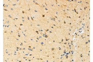 ABIN6265330 and ABIN6273170 at 1/100 staining Mouse brain tissue by IHC-P. (STBD1 anticorps  (N-Term))