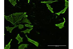 Immunofluorescence of monoclonal antibody to CKS2 on HeLa cell. (CKS2 anticorps  (AA 1-79))