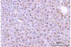 IHC analysis of Nesprin3/SYNE3 using anti-Nesprin3/SYNE3 antibody (ABIN7601328). (Nesprin3 anticorps  (AA 322-495))
