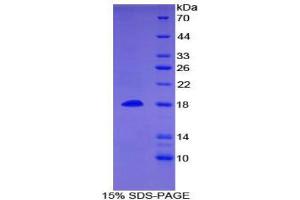 SDS-PAGE (SDS) image for Bone Morphogenetic Protein 15 (BMP15) (AA 266-388) protein (His tag) (ABIN2124142) (BMP15 Protein (AA 266-388) (His tag))