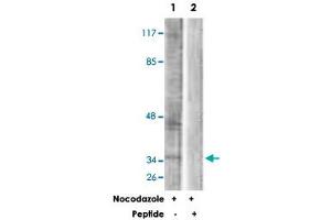 Western blot analysis of extracts from COS-7 cells, treated with Nocodazole (1 ug/mL, 16 hours), using PBK polyclonal antibody . (PBK anticorps)