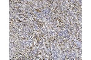 IHC analysis of Integrin linked ILK using anti-Integrin linked ILK antibody (ABIN7599410).