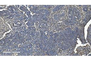 IHC analysis of L/CMBL using anti-L/CMBL antibody (ABIN7599150). (CMBL anticorps  (AA 1-246))