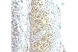 Formalin-fixed, paraffin-embedded human Tonsil stained with SUMO-2 Monoclonal Antibody (SUMO2/1199)