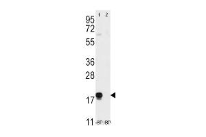 Western blot analysis of anti-THY1 Pab pre-incubated without(lane 1) and with(lane 2) blocking peptide (BP2050a) in T47D cell line lysate. (CD90 anticorps  (N-Term))