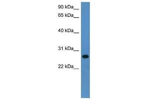 Western Blot showing Cyb5r2 antibody used at a concentration of 1-2 ug/ml to detect its target protein. (CYB5R2 anticorps  (C-Term))