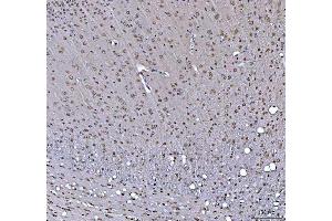 IHC analysis of RTCB using anti-RTCB antibody (ABIN7600722). (C22orf28 anticorps  (AA 227-505))