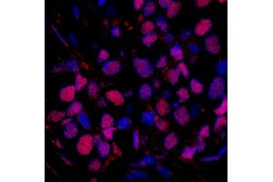 Immunofluorescence (IF) image for anti-RAD23 Homolog B (RAD23B) (AA 359-409) antibody (ABIN7449006)